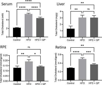 Chinese medicine, Qijudihuang pill, mediates cholesterol metabolism and regulates gut microbiota in high-fat diet-fed mice, implications for age-related macular degeneration